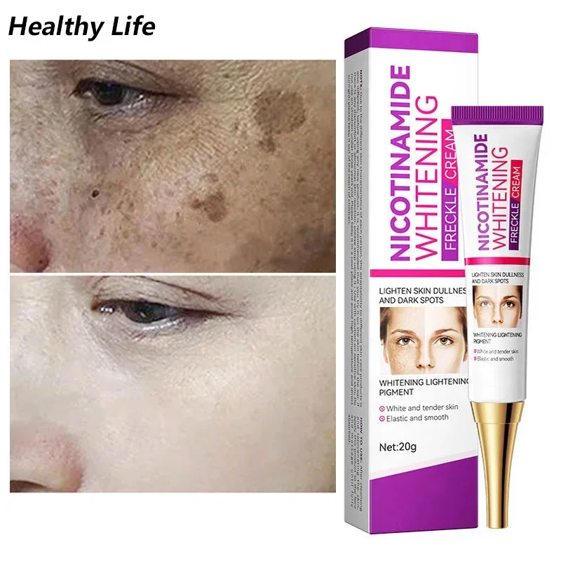 Mild Niacinamide Whitening Freckle Effective Lightens Black Spots Fade Acne Remove Melasma Brighten Korean Skin Care