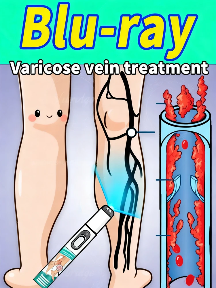 

Рождественский подарочный набор Winter Miracle Набор лазерных ручек для защиты ваших ног.