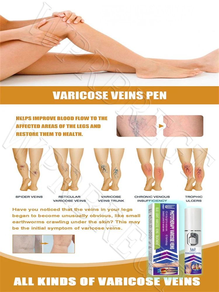 Terapia a laser de segunda geração pode ajudá-lo a remover pernas de aranha e varizes em apenas 7 dias.