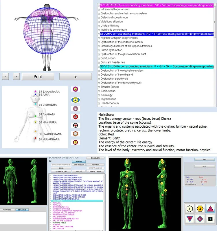 Resonantie magnetische analysator Nls Diagnostics Bioresonantietherapieapparaat 12D Nls Gezondheidsanalysator