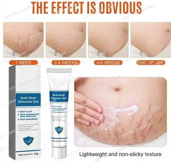 

Permanent removal of stretch marks during pregnancy, eliminating stretch marks on the abdomen of the body