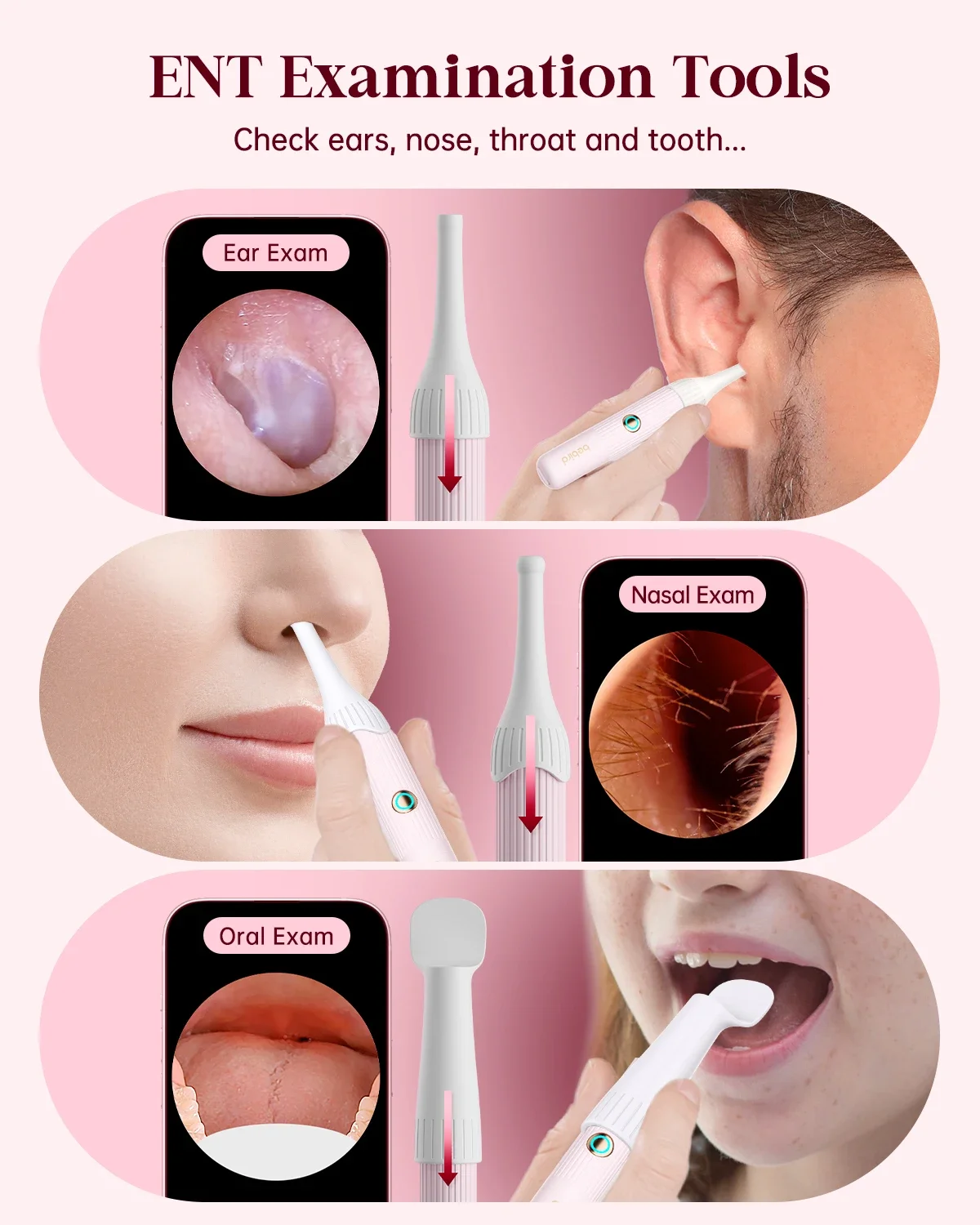 2025 Girl's Pink Bebird EarSight Plus I35R Wireless HD Visual Ear Cleaner /Camera | Clipable Tweezers & ENT Otoscope Home Use