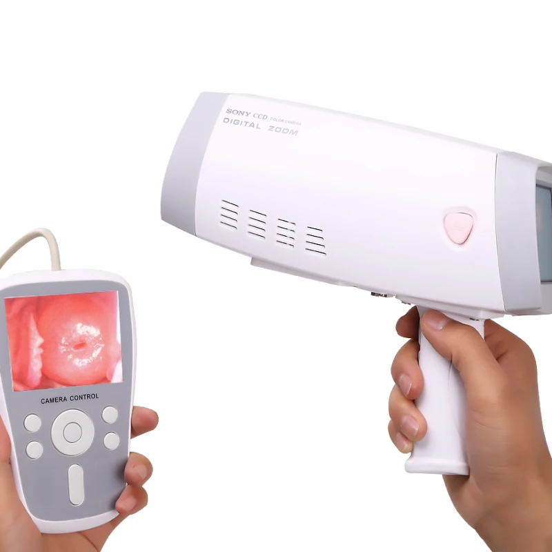 

SIN-AY08Portable портативная Гинекологическая система Colposcopy цифровое электронное видео для женщин для гинекологии