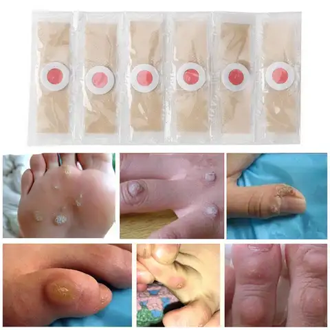 6PCS Set Foot Corn-Callus Removal Clavus Paster Toe Foot Protector Pads Self-Adhesive Sticker Soft Heel Pad Foot Skin Care Tools