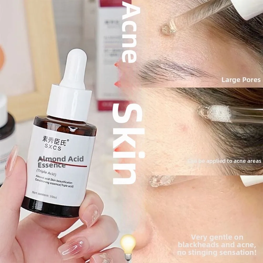 Lighten Exfoliate and Regenerate Almond Acid Serum Closed Pores for Removing Blackheads Skin Toning Essence Control Oil 30ML