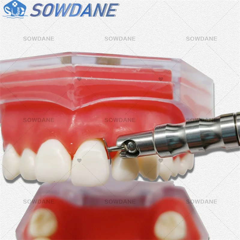 Picture 4: Adjustable Dental Implant Gingival Protecting Socket Shield Retractor Protector Gum Separator Isolation Tool Replaced tips