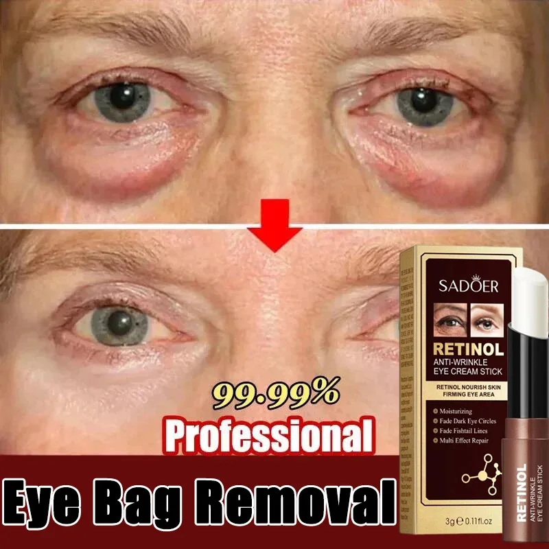 

Retinol Anti-wrinkle Eye Cream Remove Eye Bags Dark Circles Fade Fine Lines Anti-Aging Puffiness Lift Firming Brighten Eye Care