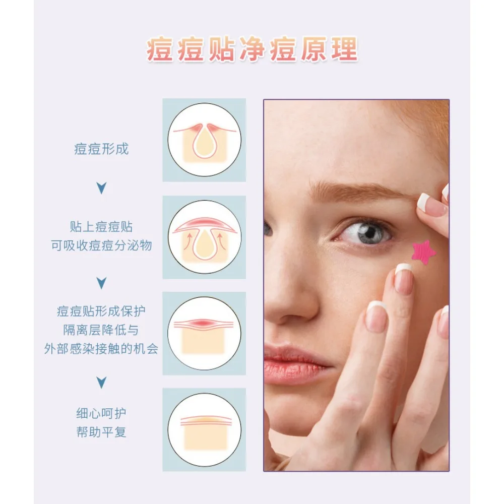 40pcs Colorful PE Pimple Patches Cute Star Shaped Pimple Cover Sticker Skin Care Sticker Concealer Face Spot Beauty Makeup Tool - Image 6