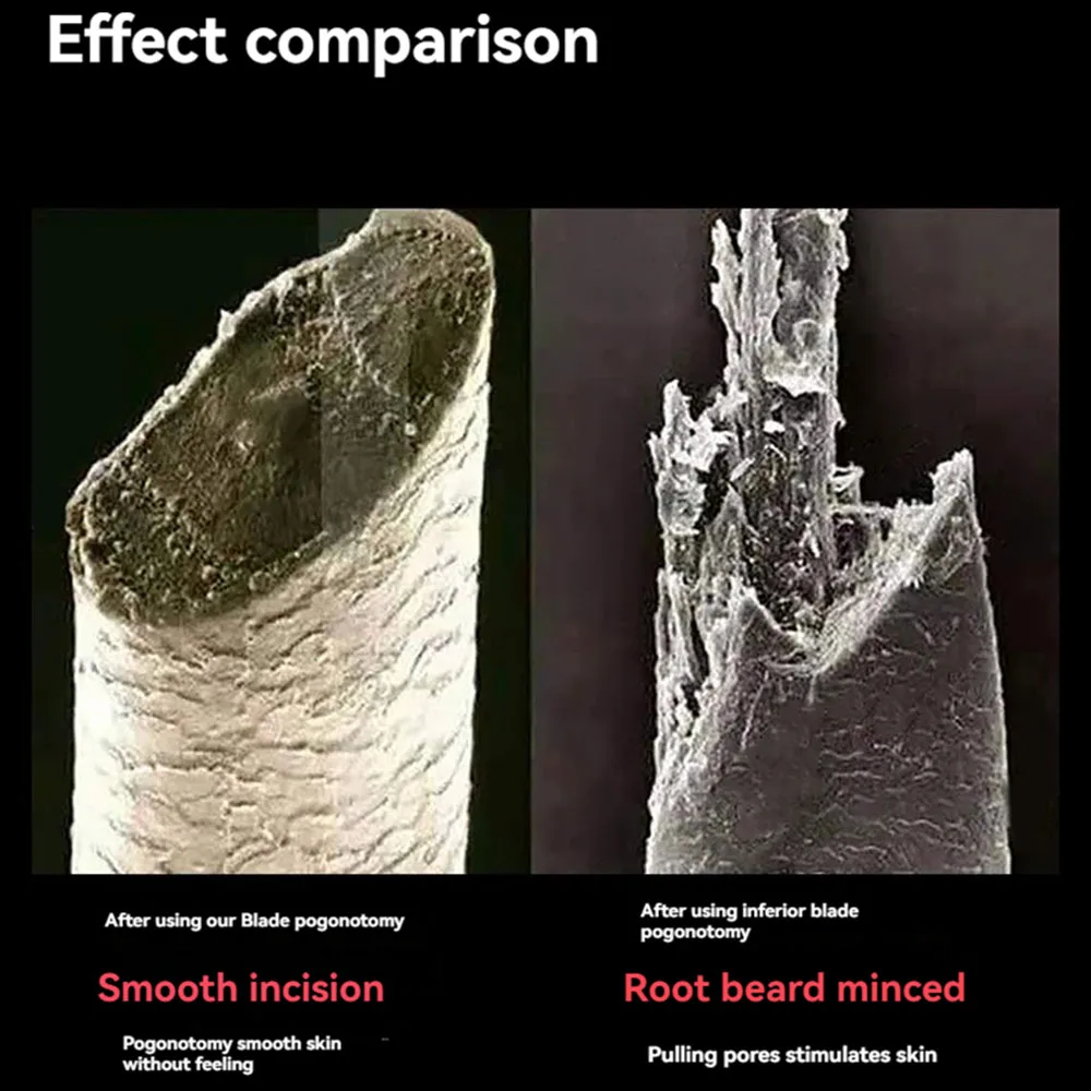 FLYDEAR 10-1000 قطعة شفرة حلاقة مكشطة من الفولاذ المقاوم للصدأ للتنظيف دون الصدأ ماكينة حلاقة الرأس المدمجة والمحمولة للرجال الأصلع #2