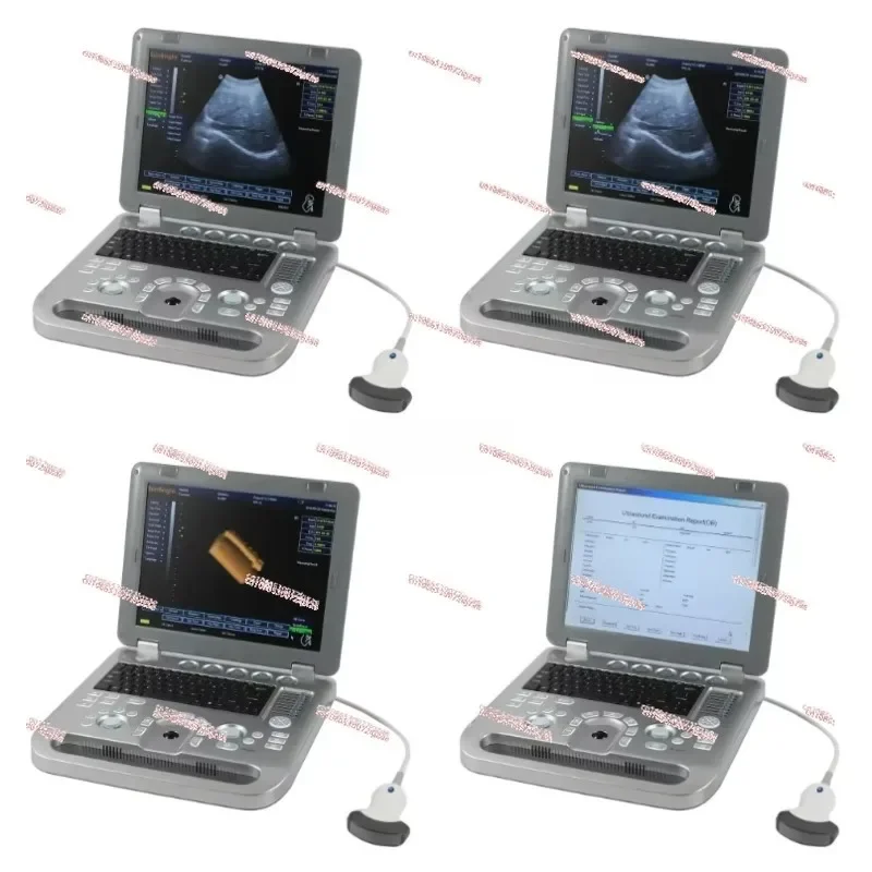 High quality 3d ultrasound machine medical scan digital pseudo color usg 4d optional ecography