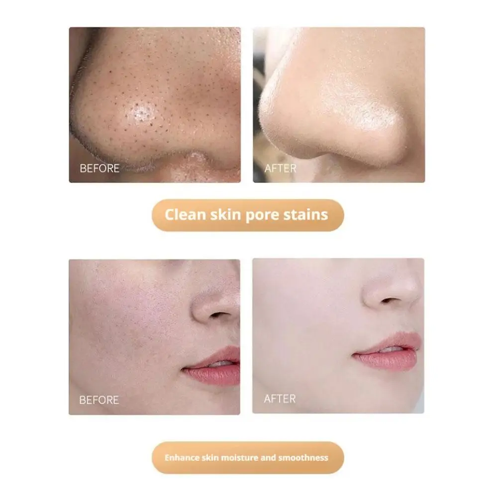 

Remove Blackhead Cleaning Mask Peel-off Mask Pores Beauty Health VC Glow Peel Off Mask Black Point Mask Face Skin Care