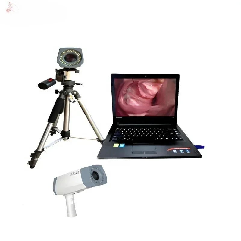 OEM Digital Colposcope  for Early Cervical Cancer Detection