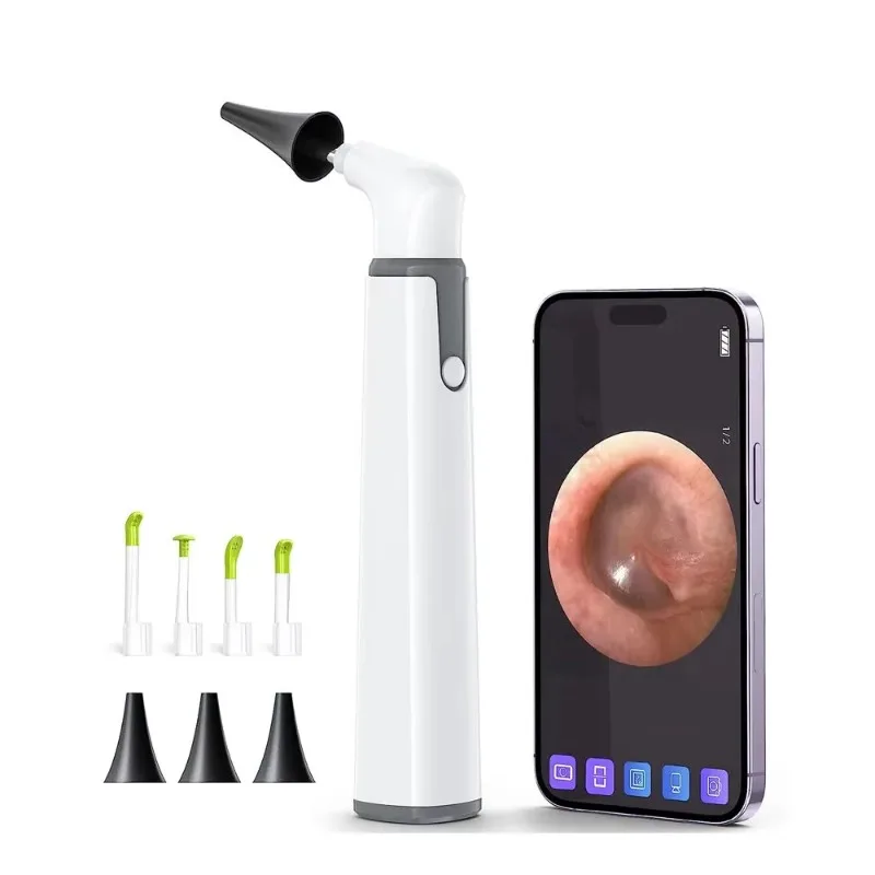 

【2026】Manual Stainless Steel Astrin Portable Otoscope High Brightness Light Precision Optics Clinics Hospitals ENT MOL