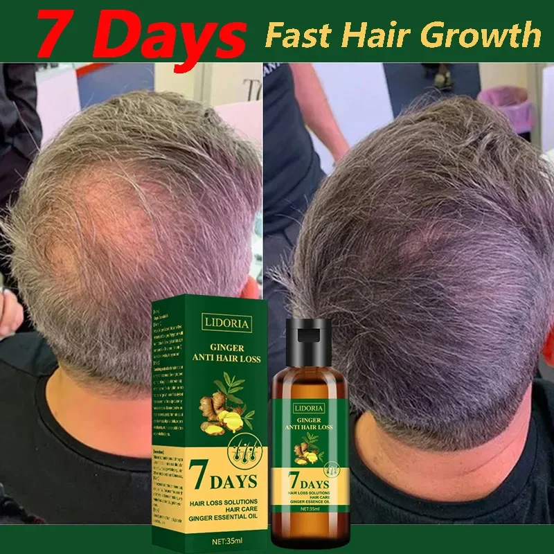 Hair Growth Serum 7 Days Fast Regrowth Essential Capsule Anti Hair Loss Baldness Repair Damaged Scalp Treatment For Women Men