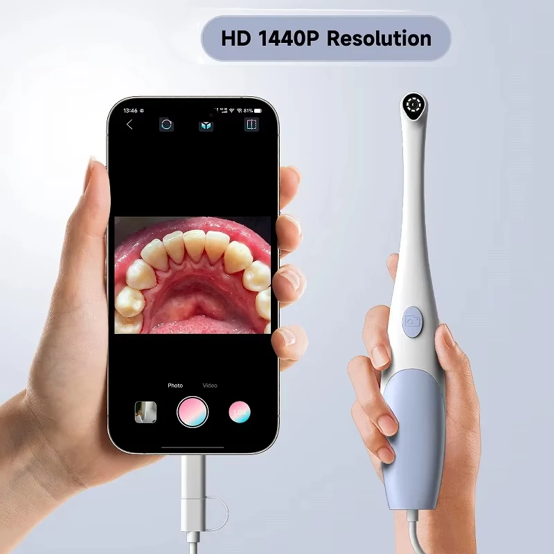 2 in1 Interface HD1440P Wired Dental Camera for iPhone Wireless Visual Dental Camera 8 PCS LED Lights Support iPhone and iPad