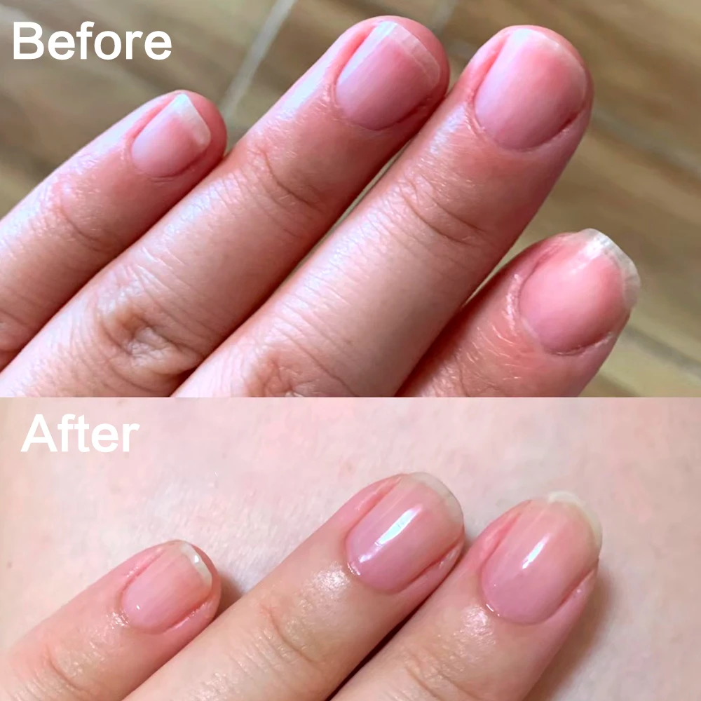 Tinovo Uno Calcium Base Coat Protein Formula Nails Growth Stronger Strengthener Foundation Normal Nail Lacquer for Repair Care