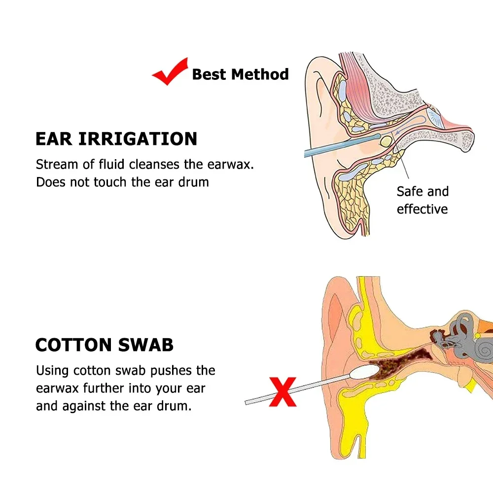 Ear Wax Cleaning Tools Family Use Earwax Removal Tips for Ear Wax Irrigation Bottle Sprayer Ear Cleaner Adults Kids Health Care