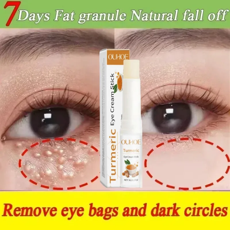 

Eye Fat Granules Removal Eyestick Anti-Puffiness Firming Cream Anti Inflammatory Fade Fine Line Repair Skin Barrier Skin Care