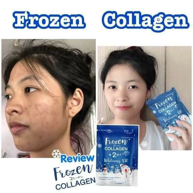 600pcs/ Frozen Collagen Whiteningx10 Younger Brightening Reduce Acne Freckles Skin Bright Whitening Antioxidant Frozen Collage