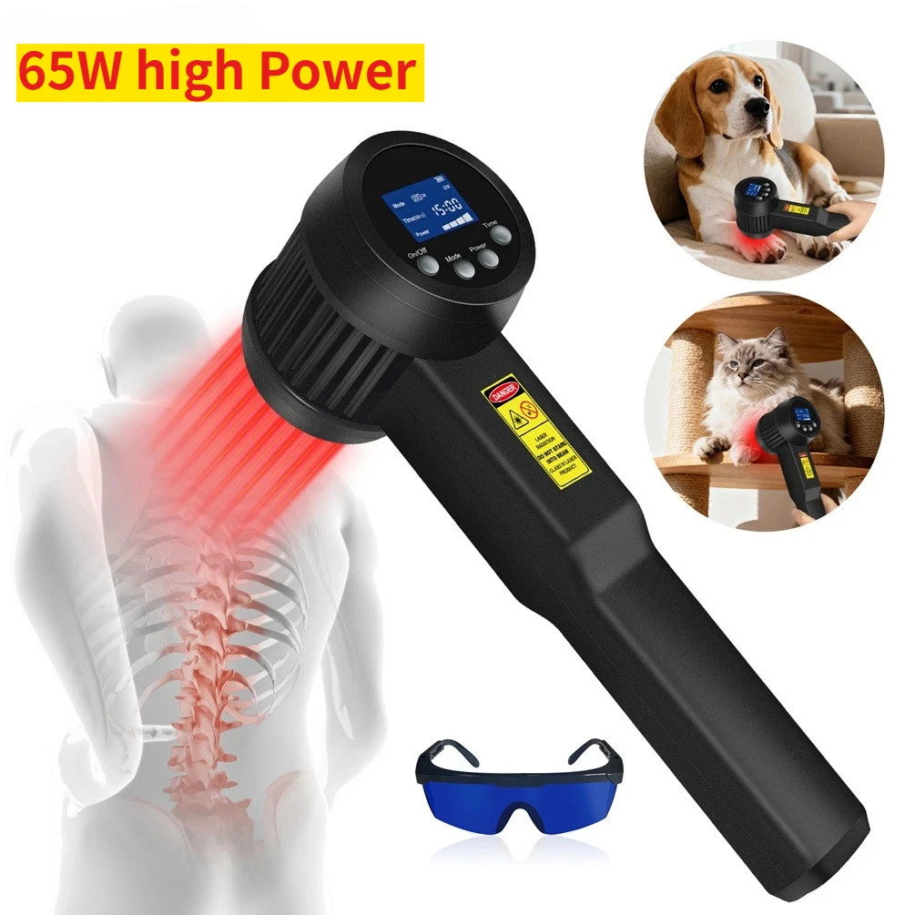 Frovab 65 واط 905nm جهاز العلاج بالليزر النبضي الفائق LLLT التهاب المفاصل الإغاثة الأنسجة العميقة إصلاح آلة العلاج الطبيعي #1