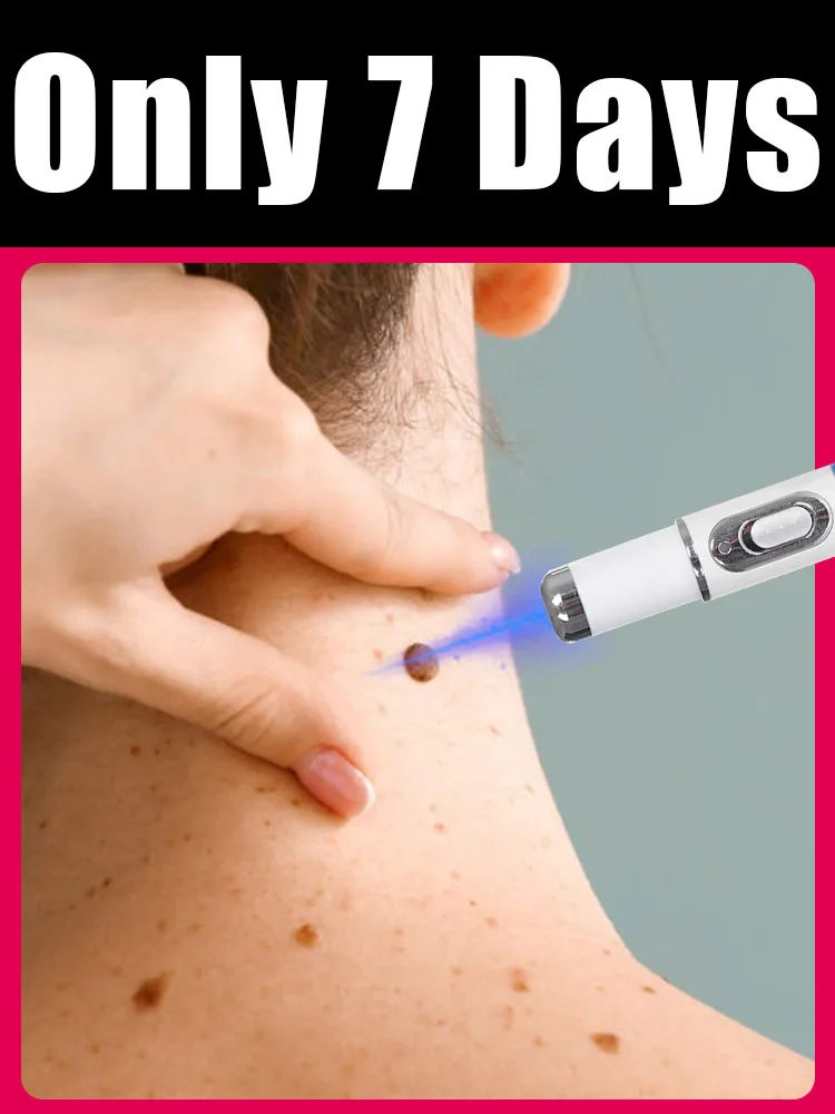 #7 Best Foot Care to Buy In 2026