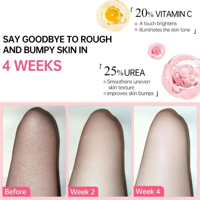 Rough Skin Removal Cream Body Whitening Smoothing Serum Repair Keratosis Pilaris Large Pore Moisturizing Brighten Dull Skin Care