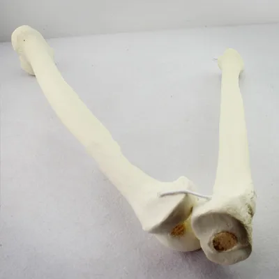 Preoperative artificial synthetic bone model for orthopedic surgery Femoral tibia model cortical bone in orthopedic surgery