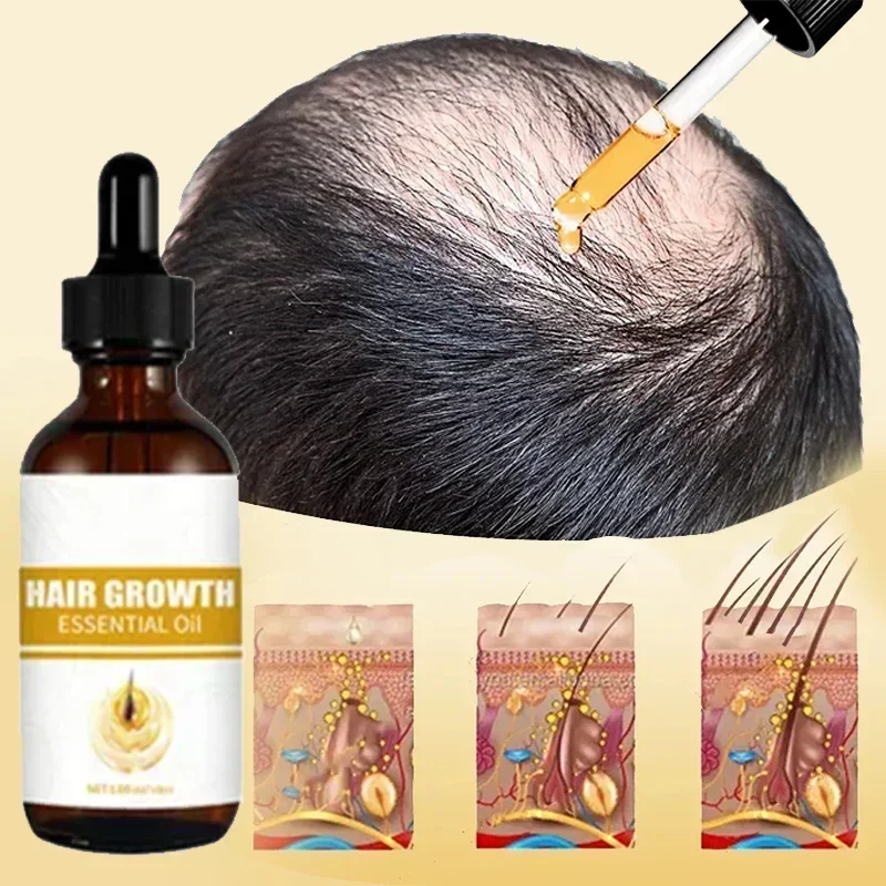 Fast Hair Growth Oil for Men Biotin Fast Treatment Baldness Serum Hair Growth Oil for Black Women