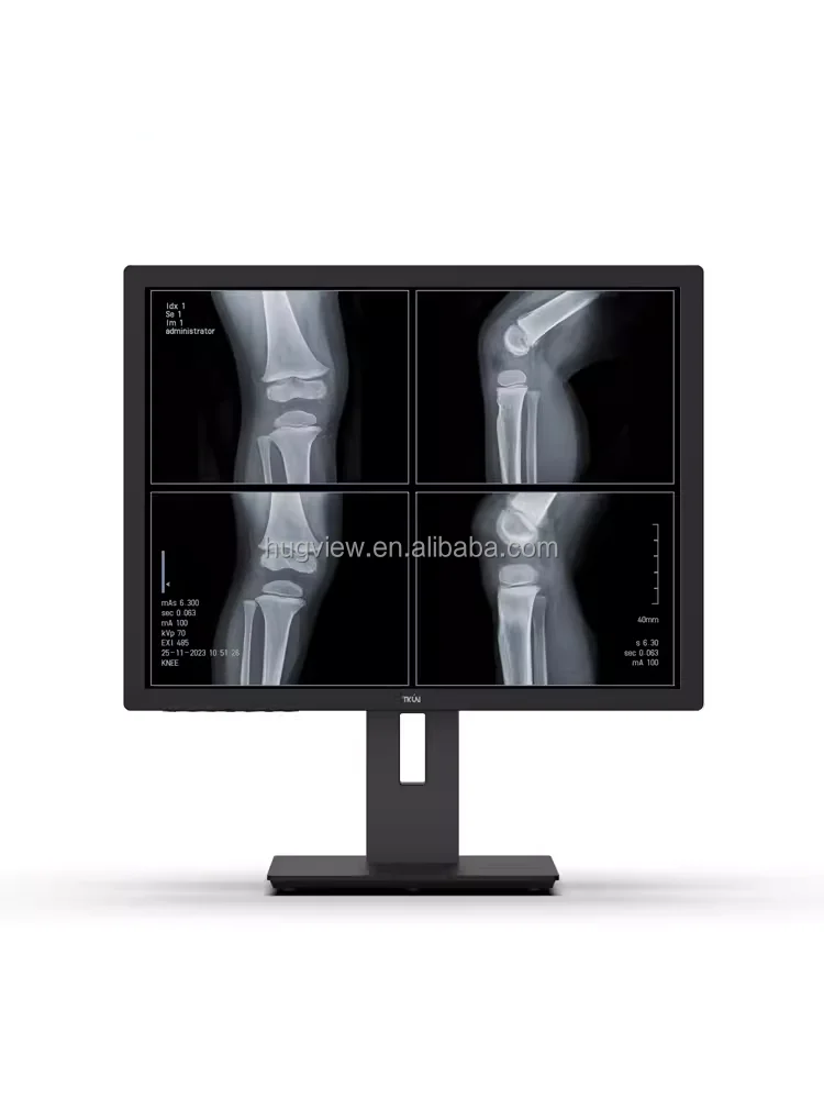 New 21.3 Inch 3Mega M Vertical Screen Grey Scale CT Reading X-ray DR Radiology Diagnostic DICOM Medical