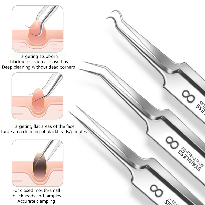 Brufoli per cellule ultrafini Pinzette per punti neri Pinzette per salone di bellezza Rimozione dell'acne Ago per punti neri Clip per pulizia profonda Strumento per la cura della pelle del viso