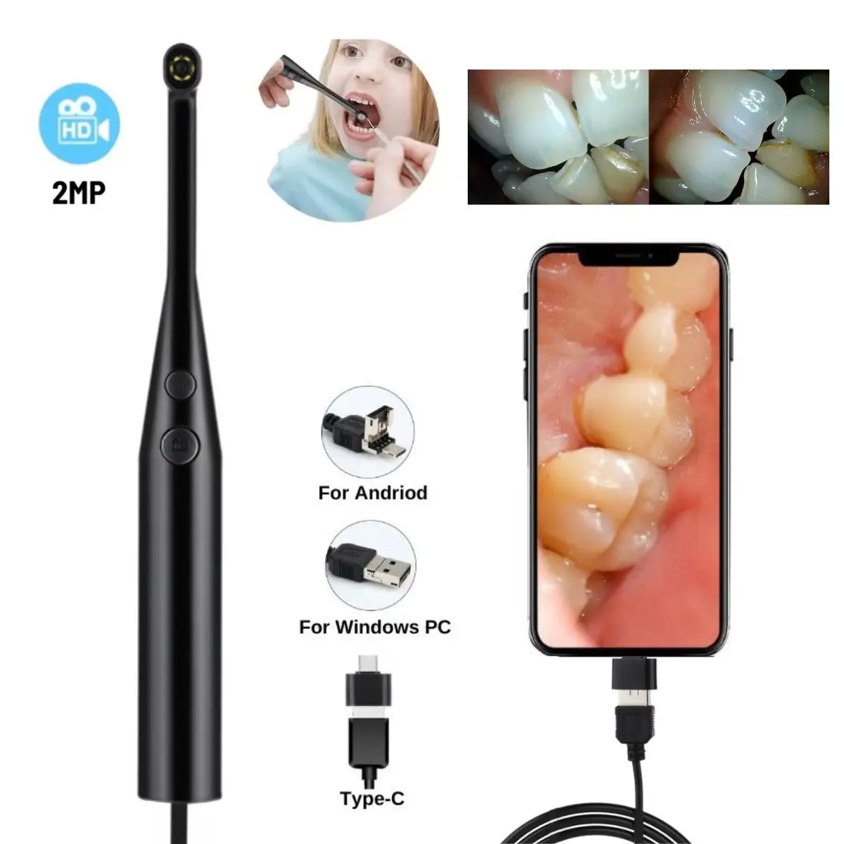 HD 200W Pixels Home Care Inspection Endoscope Camera Exam Skin、Hair Detector With 6LED Lights Pet Checking Camera For Android PC