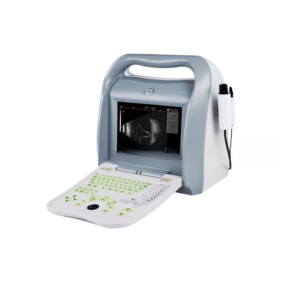 Hospital Medical Ultrasonic A B Scan Ophthalmic Biometer Pachymeter Eye Scanner…