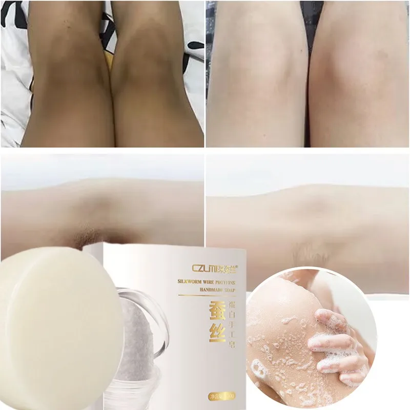 Effective Body Whitening Soap Underarm Knee Bleaching Soap Removal Chicken Skin Dark Spot Dead Skin Moisturize Brighte Body Care