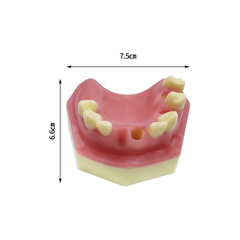 Dental Maxillary Sinus Implantation Practice Model With Missing Tooth Dental Implant Teeth Model Dentist Studying Demonstration