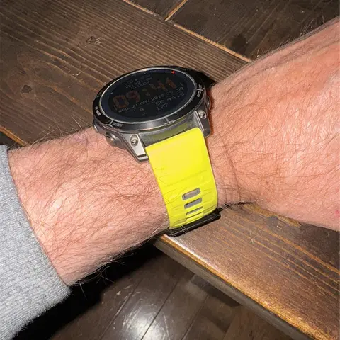 10 best sales 22 मिमी घड़ी की पट्टियाँ - №2