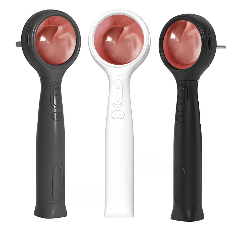 

High definition handheld ear canal endoscope with screen intelligent visual otoscope electronic otoscope otolaryngology