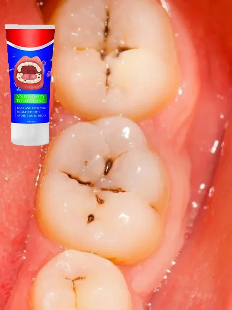 Rimuovi la placca mal di denti allevia la parodontite