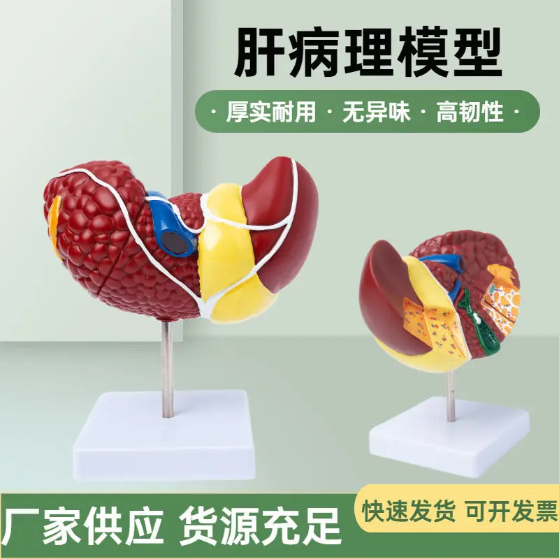 Human liver model Organ structure teaching demonstration module Visceral anatomy Hospital school liver ornament model