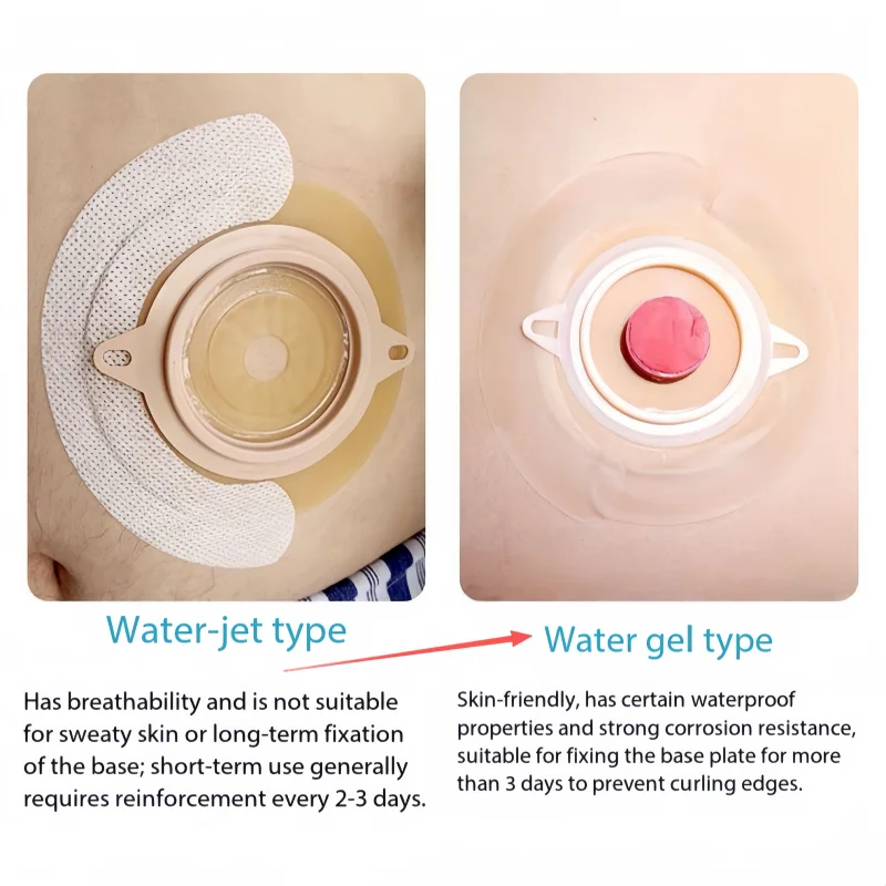 Medical Grade Hydrogel Wound Dressing, 20/40 Pockets Pocket Making Chassis Reinforcement Patch, Elastic Hydrogel Adhesive Patch