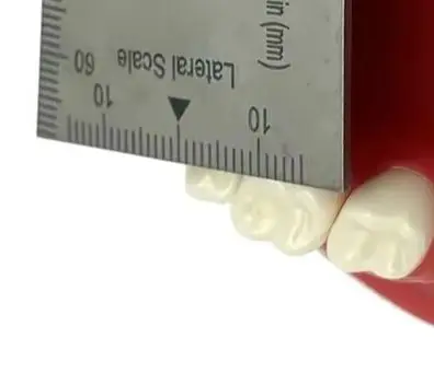 

Dental Measuring Ruler Stainless Steel Precision Measuring Ruler Dental Bite Gauge Caliper Mouth Gag Opening Capacity Ruler Tool