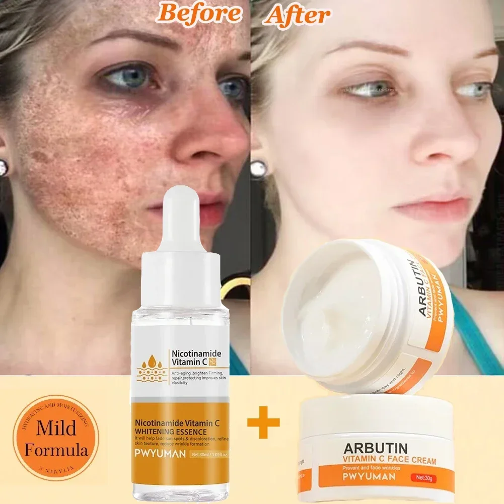 

Vitamin C Whitening Freckles Cream Nicotinamide Remove Melasma Fade Dark Spot Melanin Brighten Facial Serum Skin Care Products