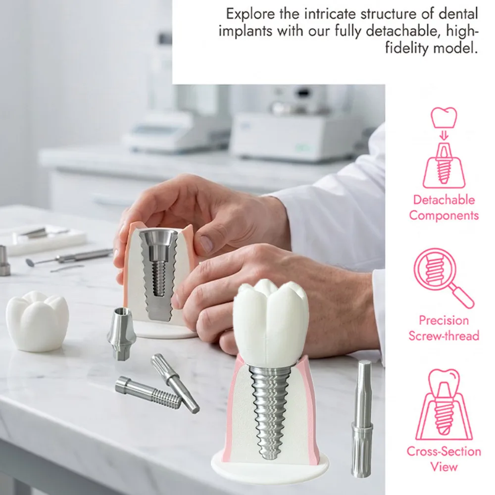 Detachable Dental Implant Demonstration Model Removable Crown & Abutment Structure Model For Dentist-Patient Communication