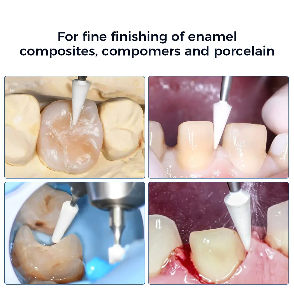 

AZDENT 5pcs/Box Dental Polishing White Stones FG 1.6mm Burs for Fine Finishing of Enamel Composites Porcelain 135℃ Autoclavable