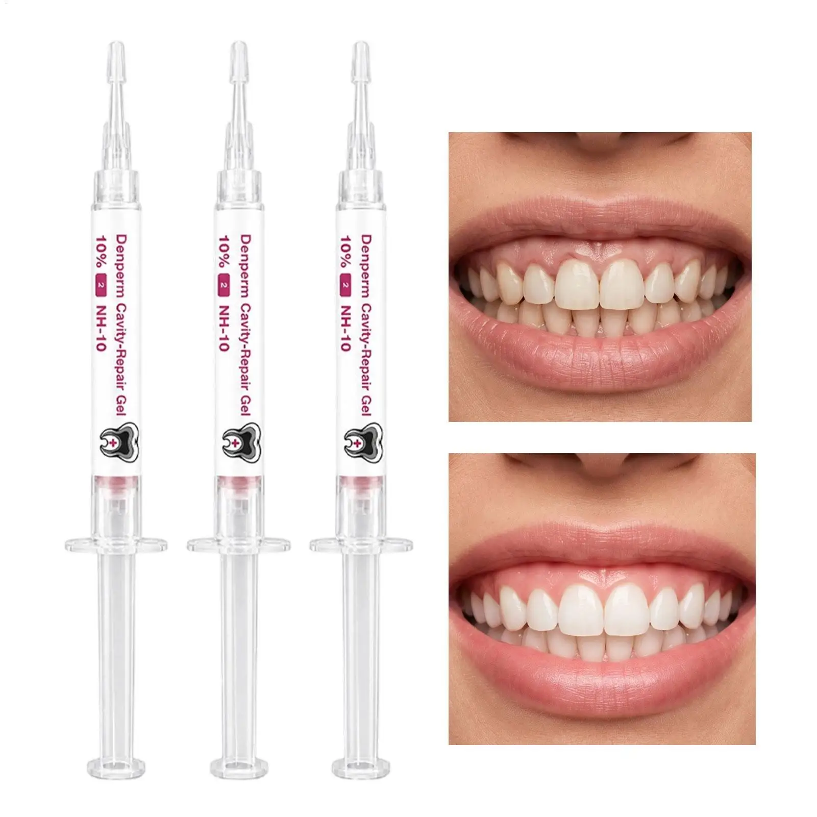 Dental Enamel Care Gel Set Tooth Repair Protection Enamel Reinforcement Daily OralCare Teeth Surface Cavity Restoration Serum