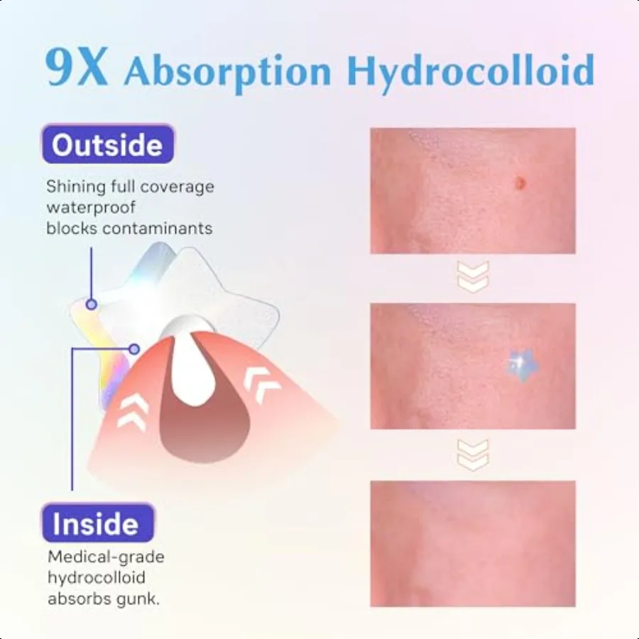 แผ่นแปะสิวโฮโลแกรมสำหรับใบหน้า แผ่นแปะสิวไฮโดรคอลลอยด์น่ารัก ผสมกรดซาลิไซลิกและทีทรี สีสันสดใส รูปดาว สำหรับสิวและรอยสิว
