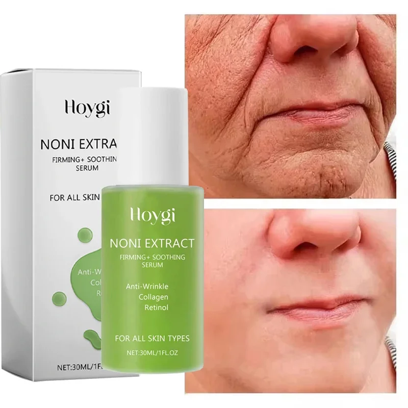 Noni Fruit Essence Noni Extract Energy Ampoule Face Serum Anti-wrinkle Moisturizing Soothing Wrinkle Fine Line Korean Skin Care