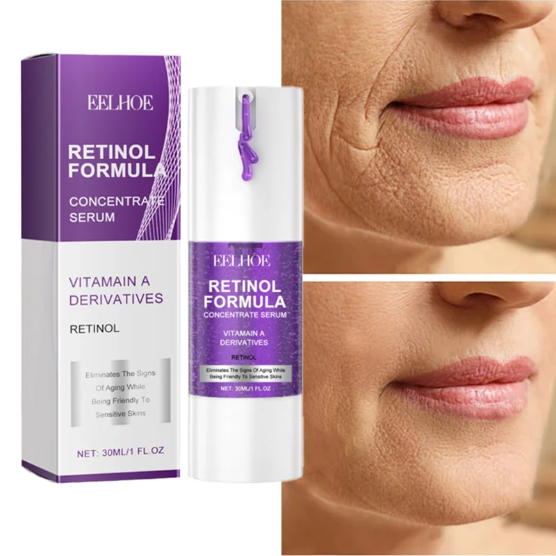 

Retinol Anti-Aging Serum Dispelling Removal Improve Firming Face Tightening Whitening Serum Forehead Korean Skincare Cosmetics