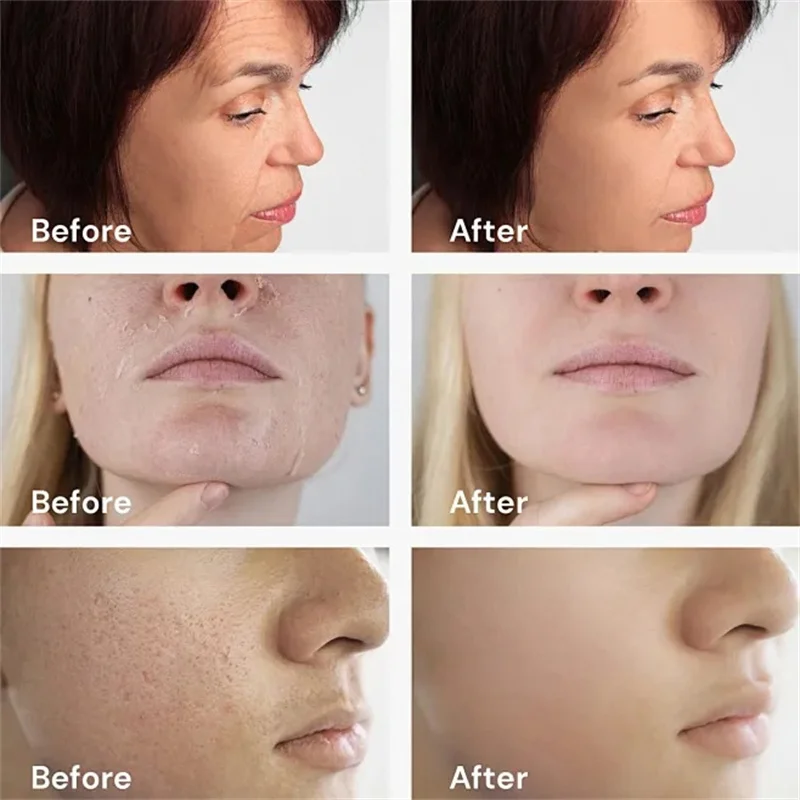 

Calcium Volume Multi Balm Anti-Aging Wrinkle Hydrating Moisturizing Wrinkle Core Stick Facial Eye Area Nasolabial Folds Remover