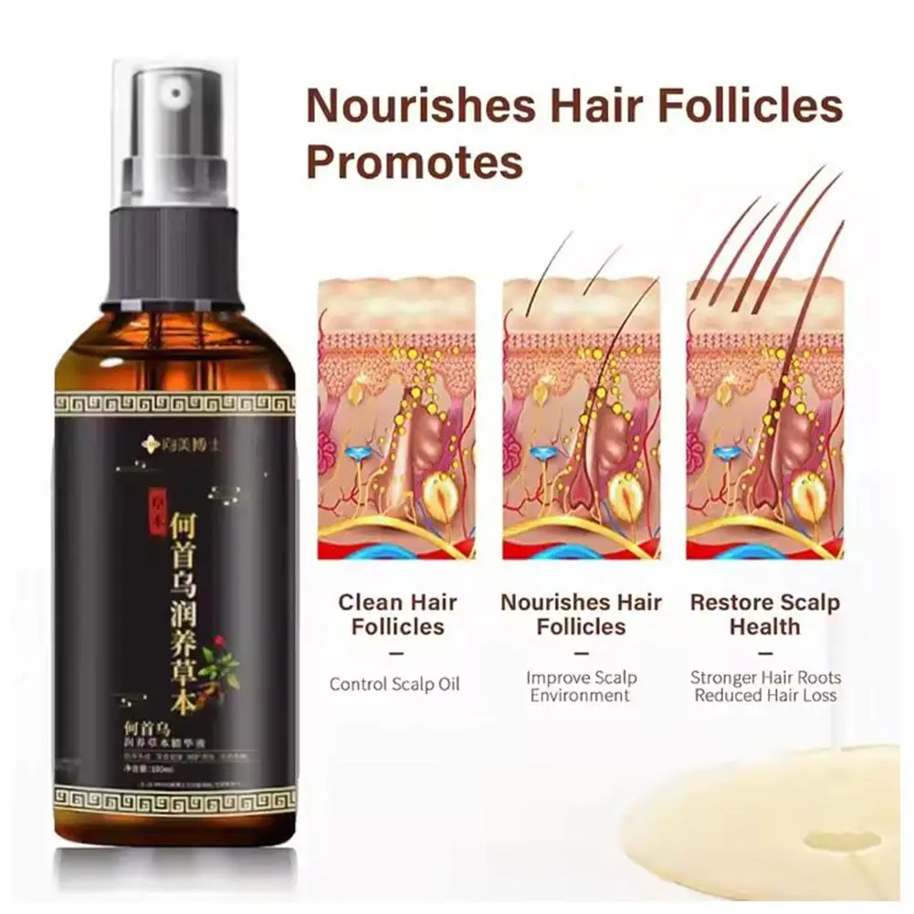 Hair Loss Solution Hair Growth Serum Spray For Men And Women,Hair Serum Polygonum Multiflori Radix, Ginger,Hair Care Essence Oil