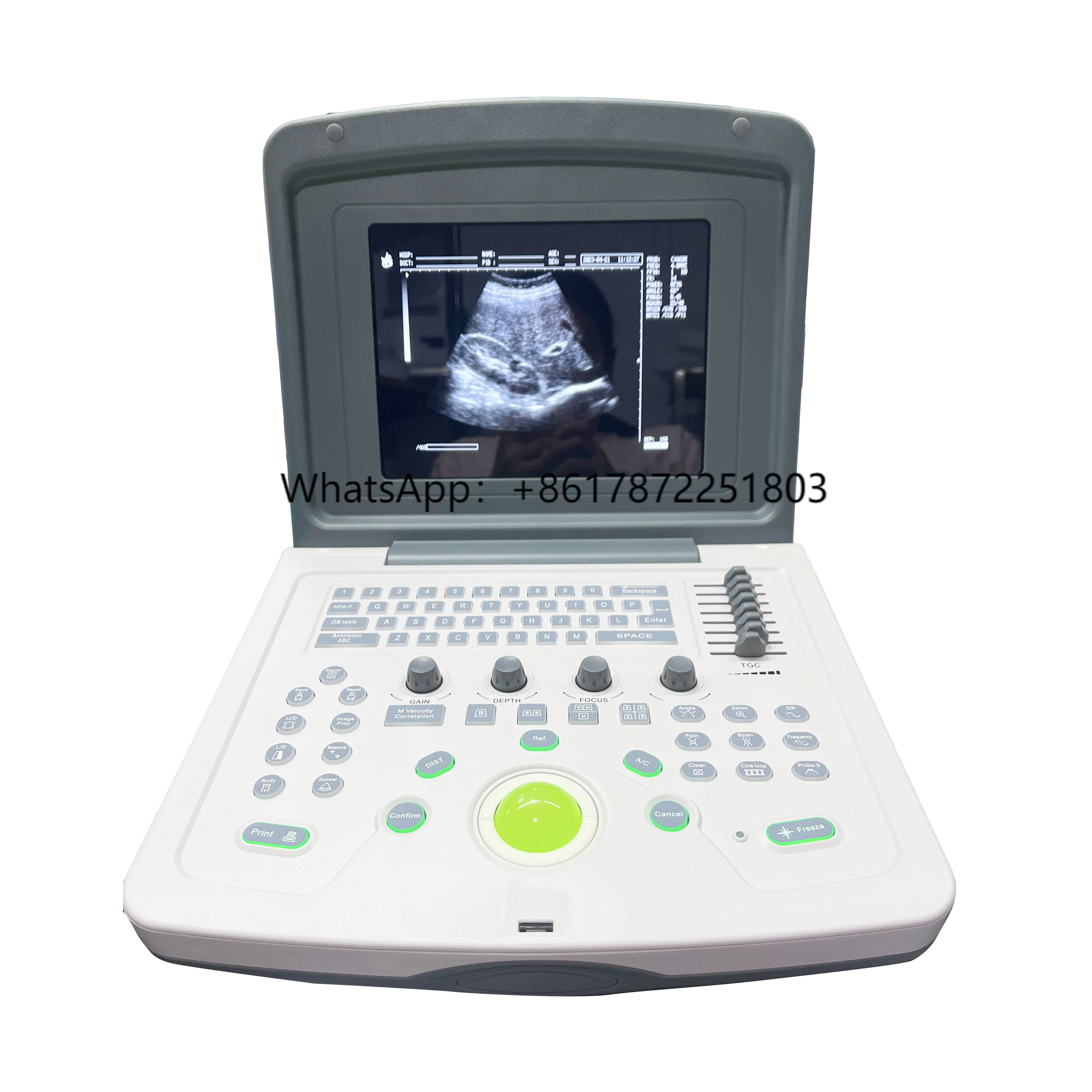 

WELLD Portable Veterinary Human Multi-Frequency Probes Laptop Full Digital Ultrasonic Diagnostic Imaging System Scanner Machine